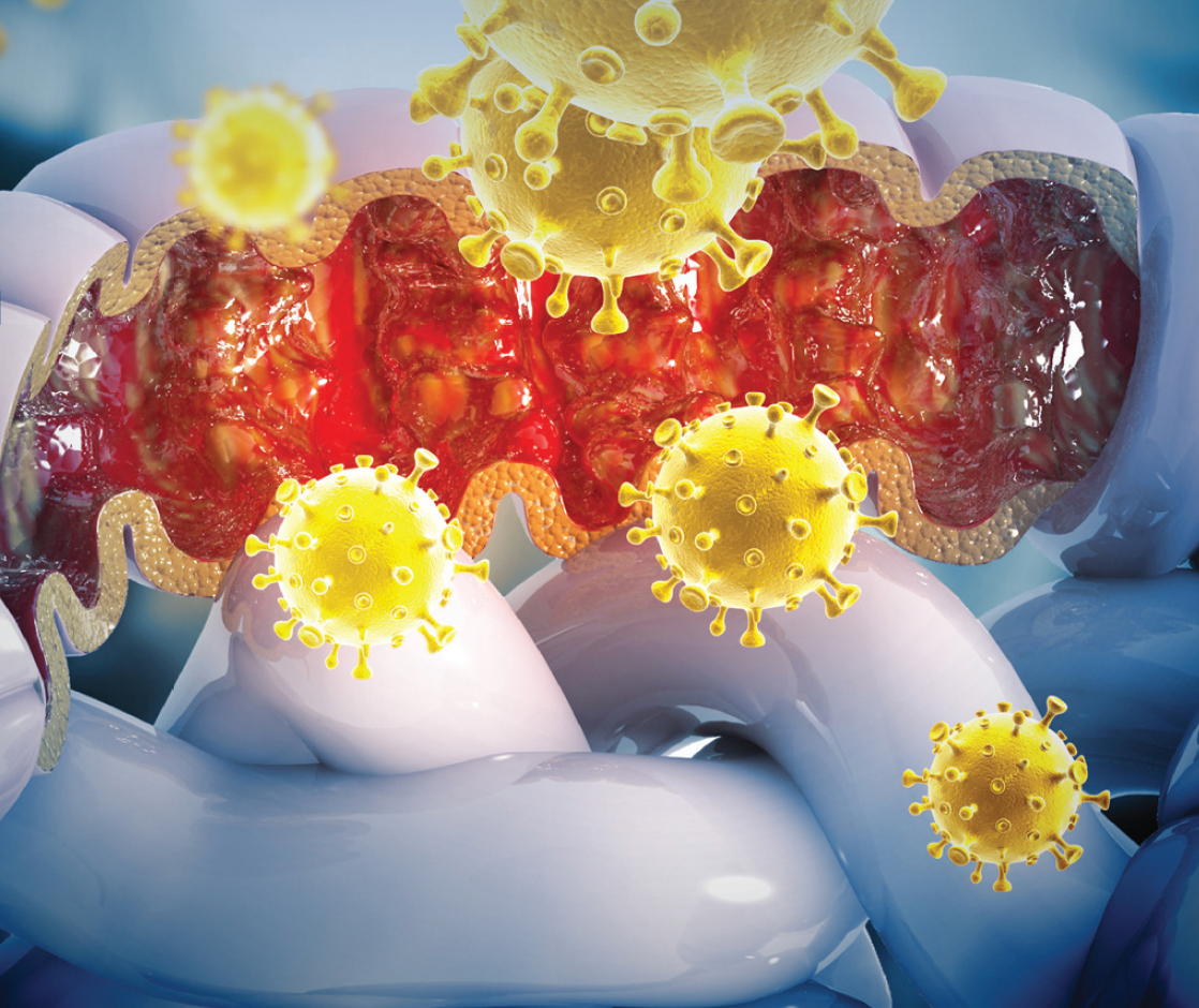 Effectiveness, Toxicity, and Survival Predictors of Regorafenib in Metastatic Colorectal Cancer: A Multicenter Study of Routinely Collected Data