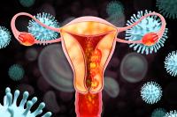 Selinexor Maintenance Does Not Meet PFS End Point in Endometrial Cancer: © Crystal light - stock.adobe.com