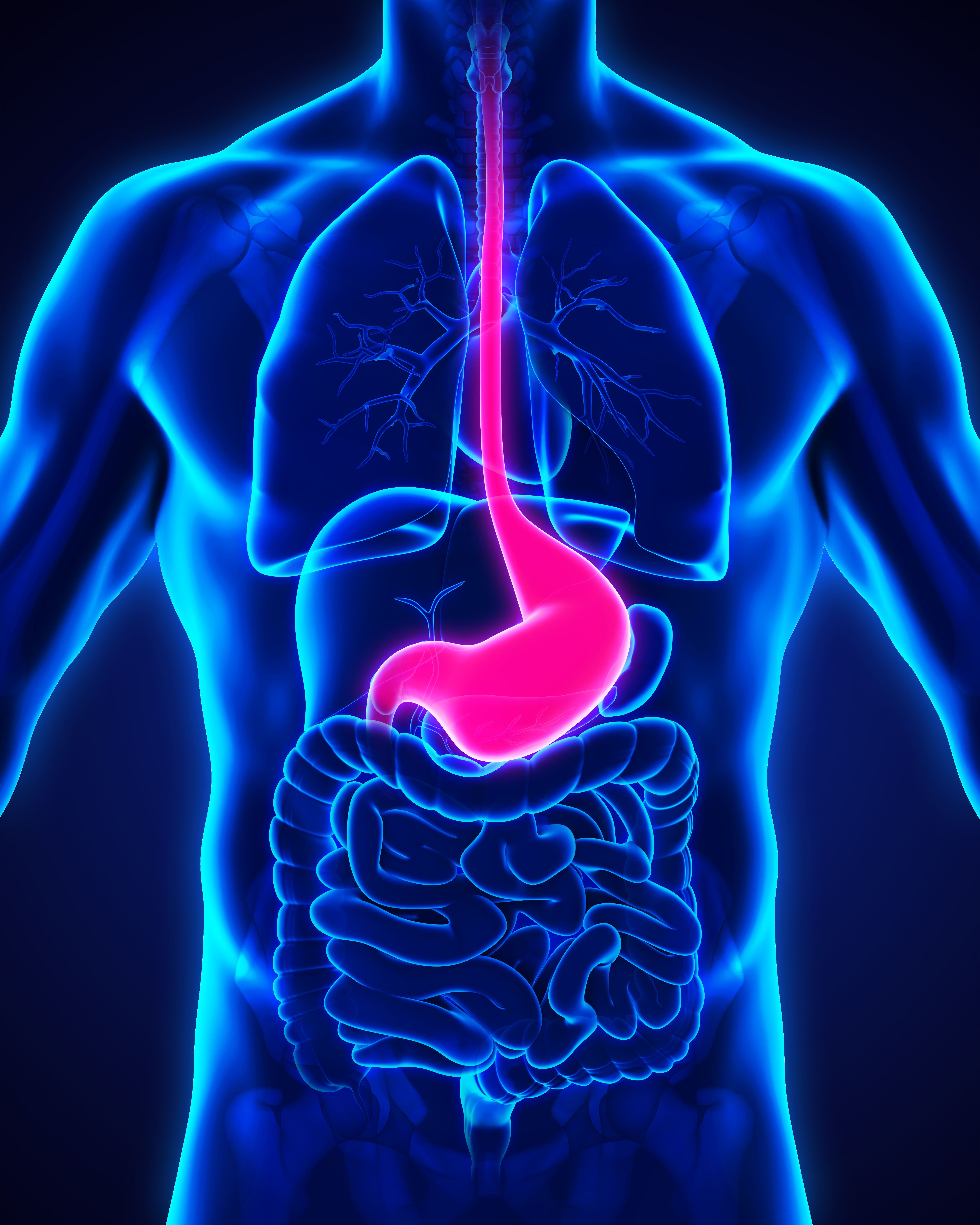 gastric cancer