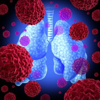 Treatment with socazolimab plus carboplatin and etoposide appears safe in patients with small cell lung cancer, according to preliminary phase 1 study findings.