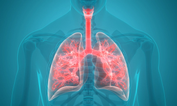 The DREAM program led by Ankit Bharat, MD, MBBS, FACS, allowed Cornelia Tischmacher to receive a double lung transplant for her stage IV lung cancer.
