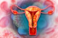 Pembrolizumab Monotherapy Improves PFS in dMMR Endometrial Cancer: © Crystal light - stock.adobe.com
