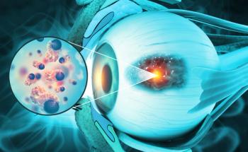 Findings from the OptimUM-02 trial may support a new potential therapeutic standard for patients with HLA-A*02:01–negative metastatic uveal melanoma.