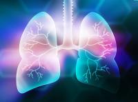Data from the SAMSON-II trial showed comparable PFS and OS outcomes with HD204 and reference bevacizumab among patients with nonsquamous NSCLC.