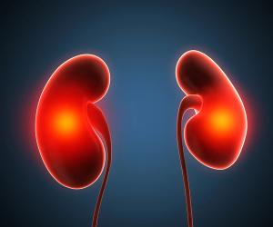 Kidney Cancer