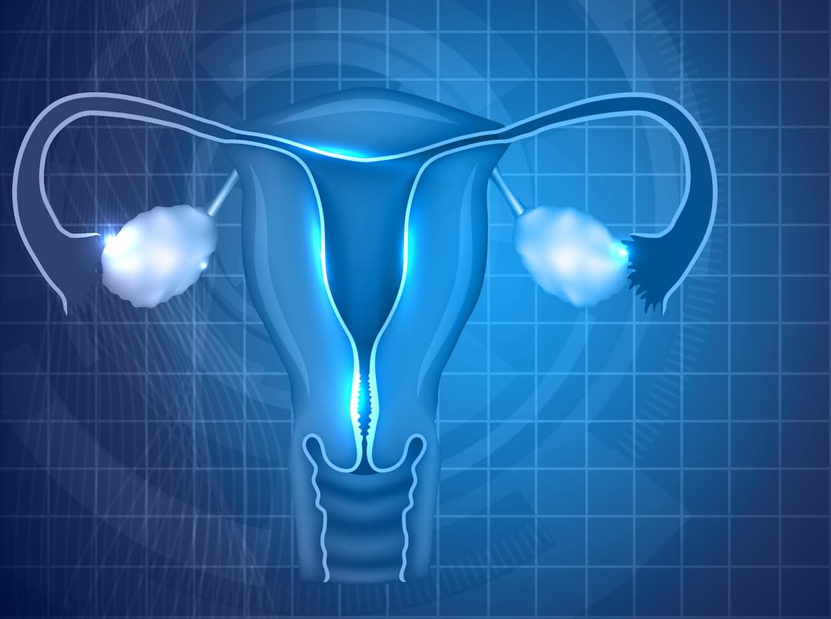 Simple hysterectomy not inferior to radical procedures in cervical ...