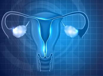 A retrospective study suggests that there might be an association between pre-existing TP53 clonal hematopoiesis of indeterminate potential variants and therapy-related myeloid neoplasms for patients with high-grade ovarian cancer following treatment with rucaparib.