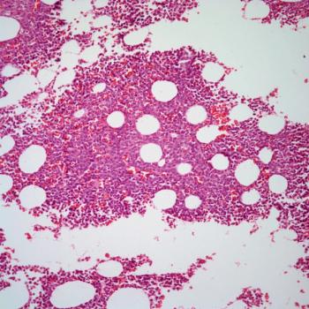 Patients who are already enrolled on clinical trials assessing magrolimab in acute myeloid leukemia are eligible to continue treatment with the agent.