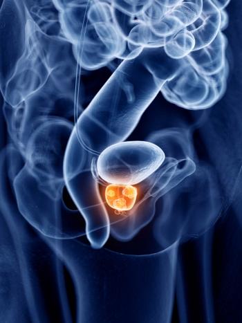 Over half of all patients with small cell neuroendocrine prostate cancer treated with BXCL701 and pembrolizumab were alive at 1 year in a phase 2 trial.