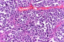 cancer network