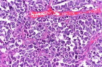 Minimal residual disease testing appears to be a valuable tool for predicting outcomes and potential relapse in patients with lymphoid malignancies.