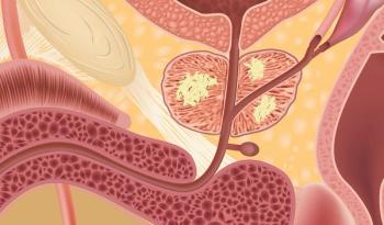 Addition of Apalutamide to ADT for nmCRPC Particularly Beneficial in Higher-Risk and Luminal Subtypes 