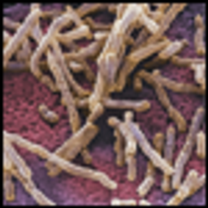 Bacterial Infections in Patients With Solid Tumors