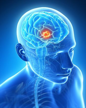 Results came from the pilot, open-label, phase 2 QUILT-3.078 trial (NCT06061809) that evaluated nogapendekin alfa inbakicept with PD-L1 t-haNK and bevacizumab in patients with recurrent or progressive glioblastoma.