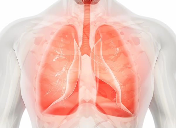 The developers plan to submit a new drug application to regulatory authorities for JS001sc for the treatment of first-line non-squamous NSCLC.