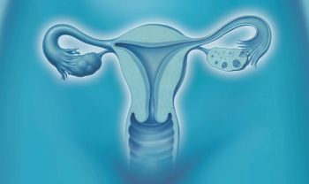 Power morcellation, uterine cancer link