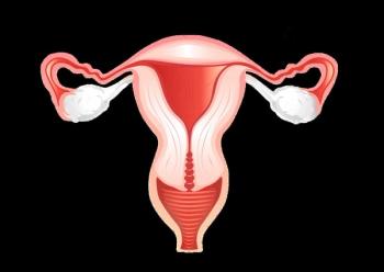 Adjuvant Pembrolizumab Plus Chemoradiotherapy Combo Will Be Investigated in High-Risk Endometrial Cancer