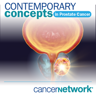 Contemporary Concepts in Prostate Cancer