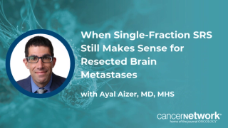Ayal Aizer, MD, MHS, discusses patients for whom single-fraction SRS may remain reasonable after brain metastasis resection.