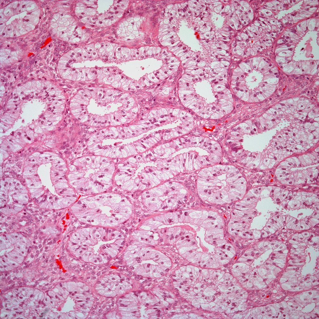 Heavy Vaginal Bleeding A 26 Year Olds Story - 318jw5c