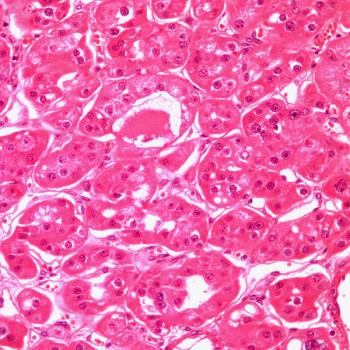 The safety profile seen in the phase 3 CONTACT-03 trial, assessing cabozantinib and atezolizumab in advanced renal cell carcinoma is consistent with previous findings.