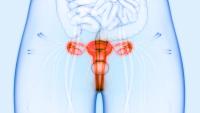Ubamatamab Yields Responses in Recurrent Low-Grade Serous Ovarian Cancer: © magicmine - stock.adobe.com
