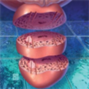 Active Surveillance for Prostate Cancer: How to Do It Right