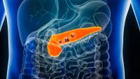 FDA Grants BTD to Olomorasib in KRAS G12C-Mutant Pancreatic Cancer: © Matthieu - stock.adobe.com