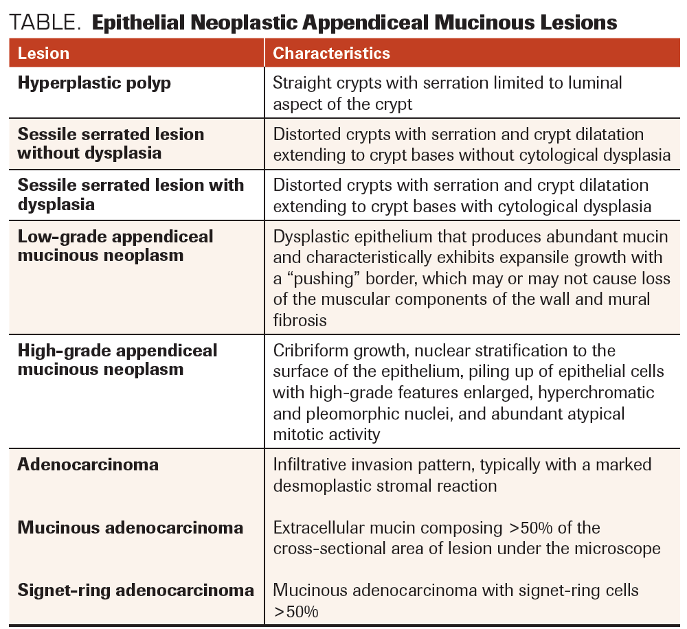TABLE. Epithelial Neoplastic Appendiceal Mucinous Lesions