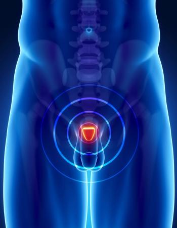 Prostate Cancer