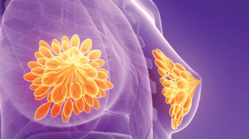 Shorter Time to Treatment Is Associated With Improved Survival in Rural Patients With Breast Cancer Despite Other Adverse Socioeconomic Factors
