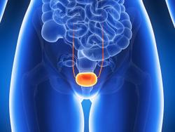FDA Accepts BLA for N-803 Plus BCG for BCG-Unresponsive Non-Muscle Invasive Bladder Carcinoma in Situ