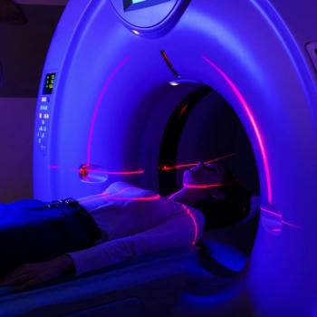 The addition of olanzapine to antiemetics might alleviate insomnia, appetite loss, anxiety, and depression in those receiving concurrent chemoradiation.