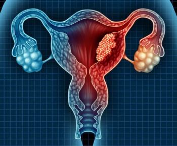 Race, Ethnicity ‘Notably Underreported’ in Publicly Accessible Databases of Gynecologic Cancer Trials