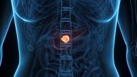 Daraxonrasib Under Phased Review Process in Pancreatic Cancer: © Sebastian Kaulitzki - stock.adobe.com