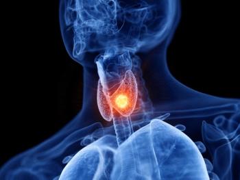 Phase 3 results show that treatment with vandetanib had no statistically significant improvement in PFS and more adverse effects than placebo.