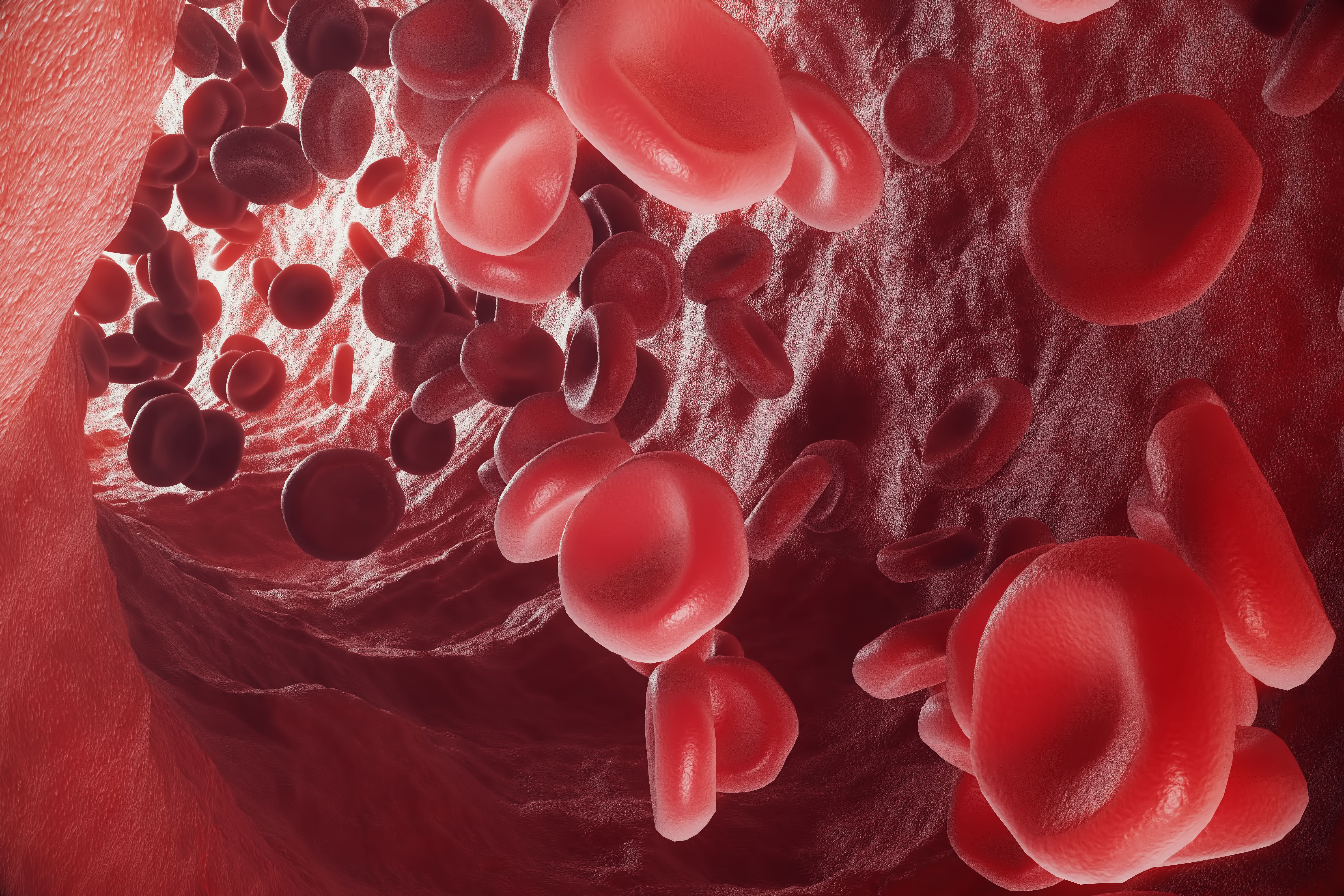 Following discussion with the FDA, INN melphalan flufenamide has been withdrawn from market in the United States based on data from the phase 3 OCEAN study.