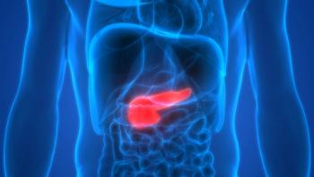 Diane Simeone, MD, spoke to the need to determine which patients are at risk of developing pancreatic cancer, the importance of early detection, and challenges that need to be addressed in order to improve survival.