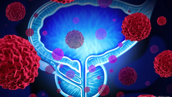 prostate cancer