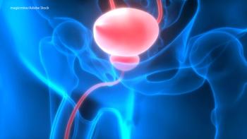 Prostate Cancer