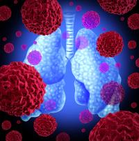 Data from the phase 3 TOP trial support a potential molecular risk–guided treatment strategy for EGFR-mutant advanced NSCLC.