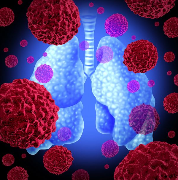 Data from the phase 3 TOP trial support a potential molecular risk–guided treatment strategy for EGFR-mutant advanced NSCLC.