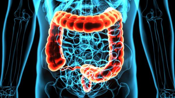 Phase 3 BATTMAN Trial in Colon Cancer Discontinued: © PIC4U - stock.adobe.com