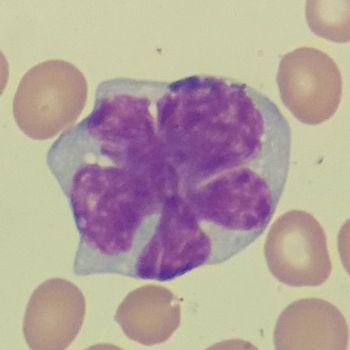 Retrospective data encourage further exploration of non-ASCT regimens in younger patients with mantle cell lymphoma, while maintenance rituximab should be considered following first-line therapy with bendamustine plus rituximab.