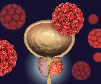 More detailed overall survival results from the phase 3 EMBARK trial for patients with nmHSPC will be shared at an upcoming medical conference.