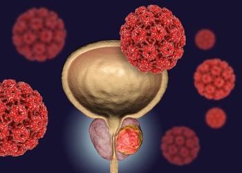 Discover the latest advancements in metastatic castration-resistant prostate cancer care, including personalized treatment strategies and emerging therapies.