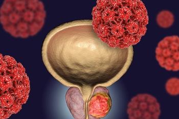 More detailed overall survival results from the phase 3 EMBARK trial for patients with nmHSPC will be shared at an upcoming medical conference.
