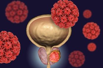 Discover the latest advancements in metastatic castration-resistant prostate cancer care, including personalized treatment strategies and emerging therapies.