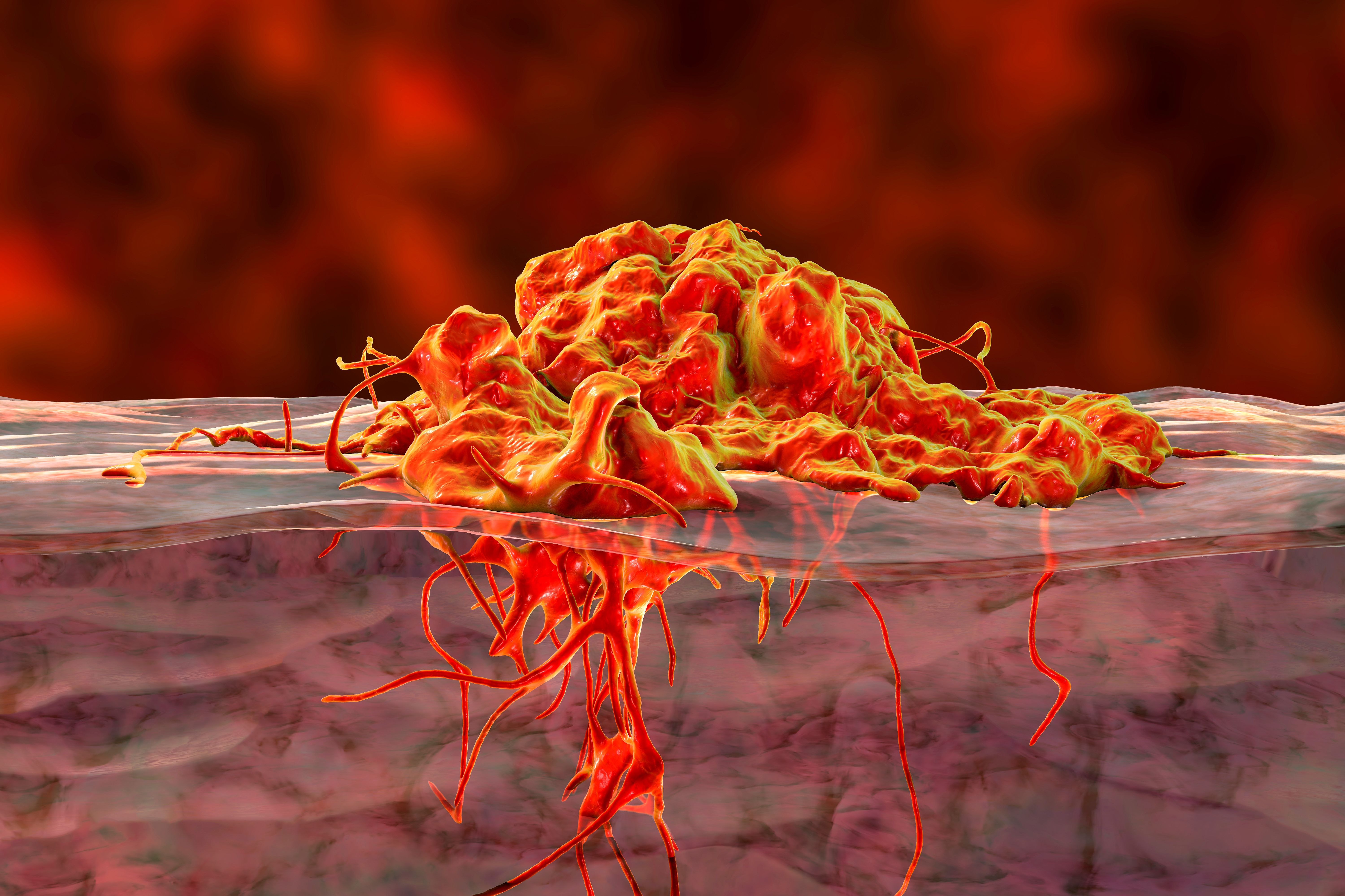 Invasive cancer growth: © Dr_Microbe - stock.adobe.com