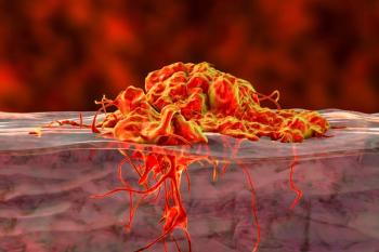 Invasive cancer growth: © Dr_Microbe - stock.adobe.com